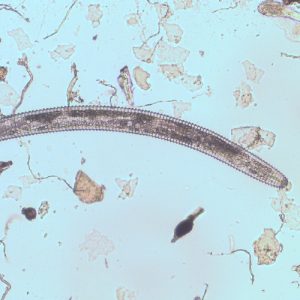 Ring Nematode