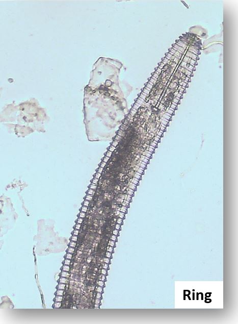 Microscopic image of a Ring Nematode